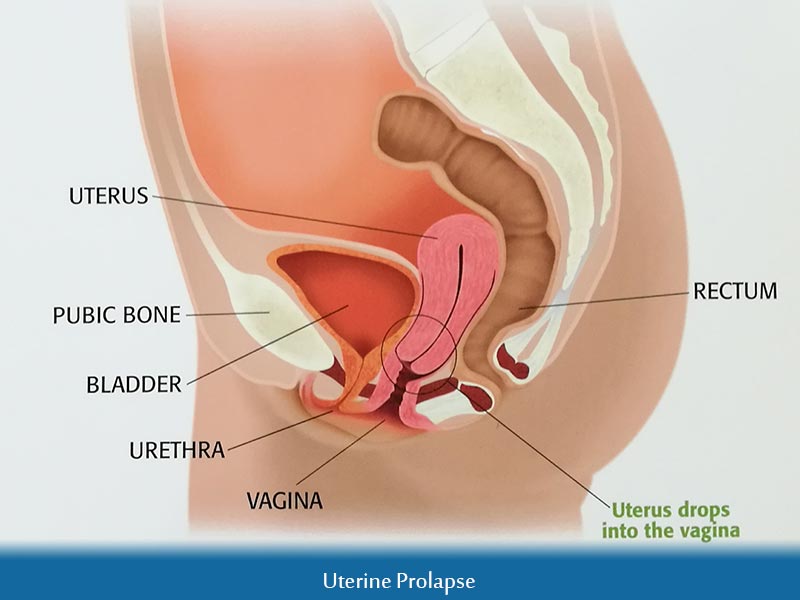 Larging my pee hole