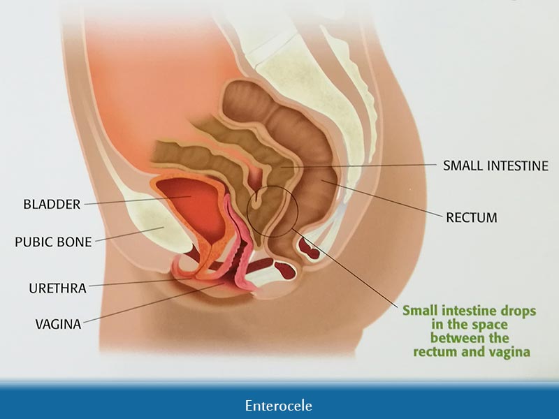 Vagina and female nude images