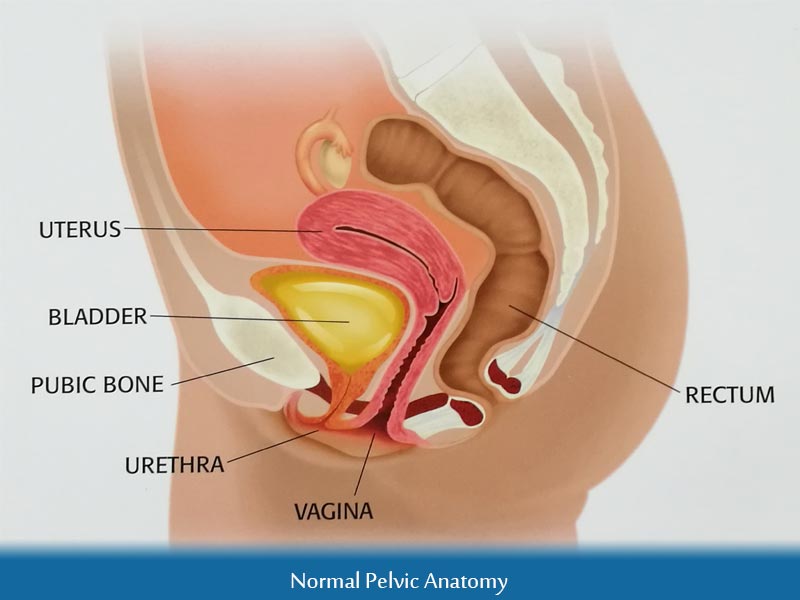 Immediately post op with reduction of the procidentia and